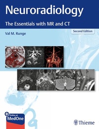 Abbildung von: Neuroradiology - Thieme Publishers