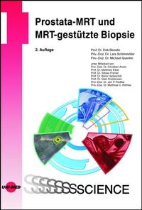 Abbildung von: Prostata-MRT und MRT-gestützte Biopsie - UNI-MED