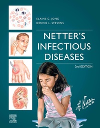 Bild: Netter's Infectious Diseases - E-Book - Elsevier