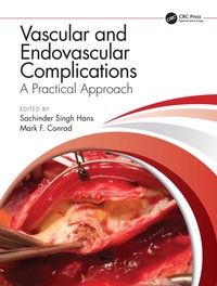 Abbildung von: Vascular and Endovascular Complications: A Practical Approach - CRC Press