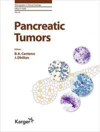 Abbildung von: Pancreatic Tumors - S. Karger
