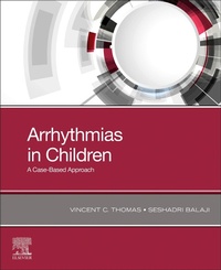 Abbildung von: Arrhythmias in Children - Elsevier