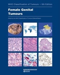 Cover: WHO classification of female genital tumours - IARC