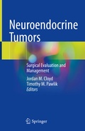 Bild: Neuroendocrine Tumors - Springer