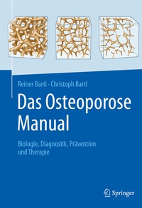 Abbildung von: Das Osteoporose Manual - Springer