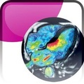 Cover: Eacvi Textbook of Cardiovascular Magnetic Resonance - Oxford University Press, USA