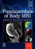 Cover: Fundamentals of Body MRI - Elsevier
