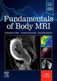 Abbildung von: Fundamentals of Body MRI - Elsevier