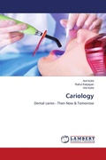 Cover: Cariology - LAP Lambert Academic Publishing