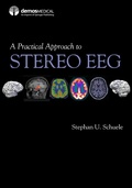 Abbildung von: A Practical Approach to Stereo EEG - Springer Publishing Company