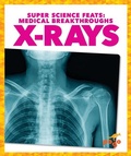Cover: X-Rays - Pogo Books