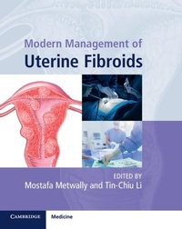 Abbildung von: Modern Management of Uterine Fibroids - Cambridge University Press