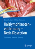 Cover: Halslymphknotenentfernung - Neck-Dissection - Springer