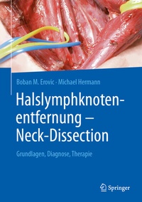 Abbildung von: Halslymphknotenentfernung - Neck-Dissection - Springer
