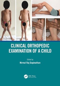 Abbildung von: Clinical Orthopedic Examination of a Child - CRC Press