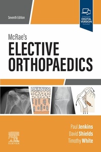 Abbildung von: McRae's Elective Orthopaedics E-Book - Elsevier