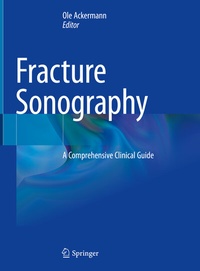 Abbildung von: Fracture Sonography - Springer