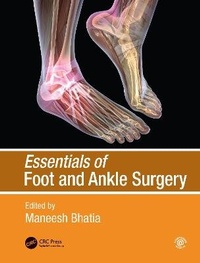 Abbildung von: Essentials of Foot and Ankle Surgery - CRC Press