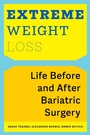 Cover: Extreme Weight Loss - New York University Press