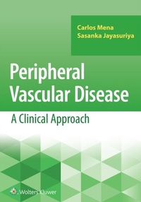Abbildung von: Peripheral Vascular Disease: A Clinical Approach - Wolters Kluwer Health