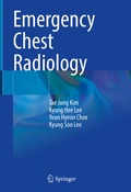 Cover: Emergency Chest Radiology - Springer