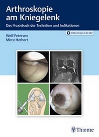 Abbildung von: Arthroskopie am Kniegelenk - Thieme