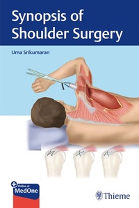 Abbildung von: Synopsis of Shoulder Surgery - Thieme Publishers