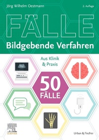 Abbildung von: Die 50 wichtigsten Fälle Bildgebende Verfahren - Urban & Fischer