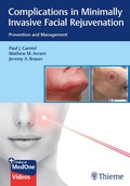 Cover: Complications in Minimally Invasive Facial Rejuvenation - Thieme Publishers