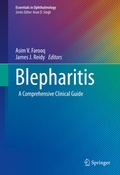 Cover: Blepharitis - Springer