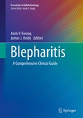 Cover: Blepharitis - Springer