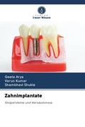 Cover: Zahnimplantate - Verlag Unser Wissen