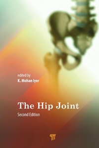 Abbildung von: The Hip Joint - Pan Stanford Publishing Pte Ltd