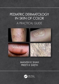 Abbildung von: Pediatric Dermatology in Skin of Color - CRC Press