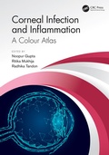 Cover: Corneal Infection and Inflammation - CRC Press