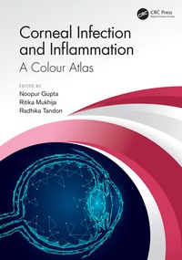 Enlarge image Cover: Corneal Infection and Inflammation - CRC Press