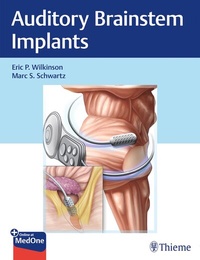 Abbildung von: Auditory Brainstem Implants - Thieme Publishers