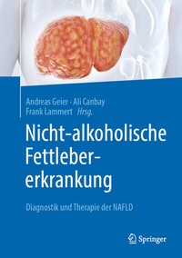 Abbildung von: Nicht-alkoholische Fettlebererkrankung - Springer