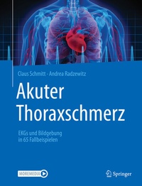 Abbildung von: Akuter Thoraxschmerz - Springer