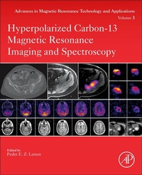 Abbildung von: Hyperpolarized Carbon-13 Magnetic Resonance Imaging and Spectroscopy: Volume 3 - Academic Press