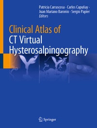 Abbildung von: Clinical Atlas of CT Virtual Hysterosalpingography - Springer
