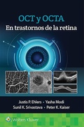 Cover: OCT y OCTA en trastornos de la retina - Ovid Technologies