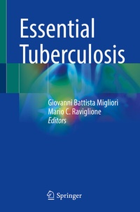 Abbildung von: Essential Tuberculosis - Springer