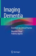 Abbildung von: Imaging Dementia - Springer