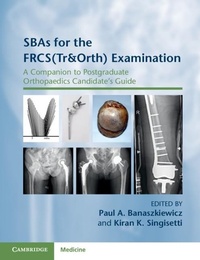 Abbildung von: SBAs for the FRCS(Tr&Orth) Examination - Cambridge University Press