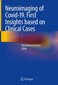 Abbildung von: Neuroimaging of Covid-19. First Insights based on Clinical Cases - Springer