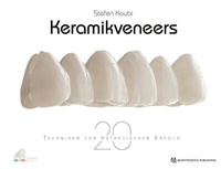 Abbildung von: Keramikveneers - Quintessenz Verlag