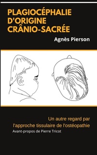 Abbildung von: plagiocéphalie d'origine crânio-sacrée - BoD - Books on Demand