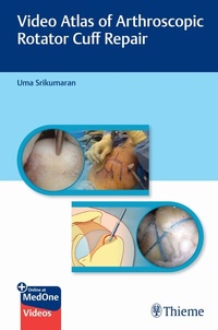 Abbildung von: Video Atlas of Arthroscopic Rotator Cuff Repair - Thieme Publishers