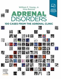 Abbildung von: Adrenal Disorders,E-Book - Elsevier